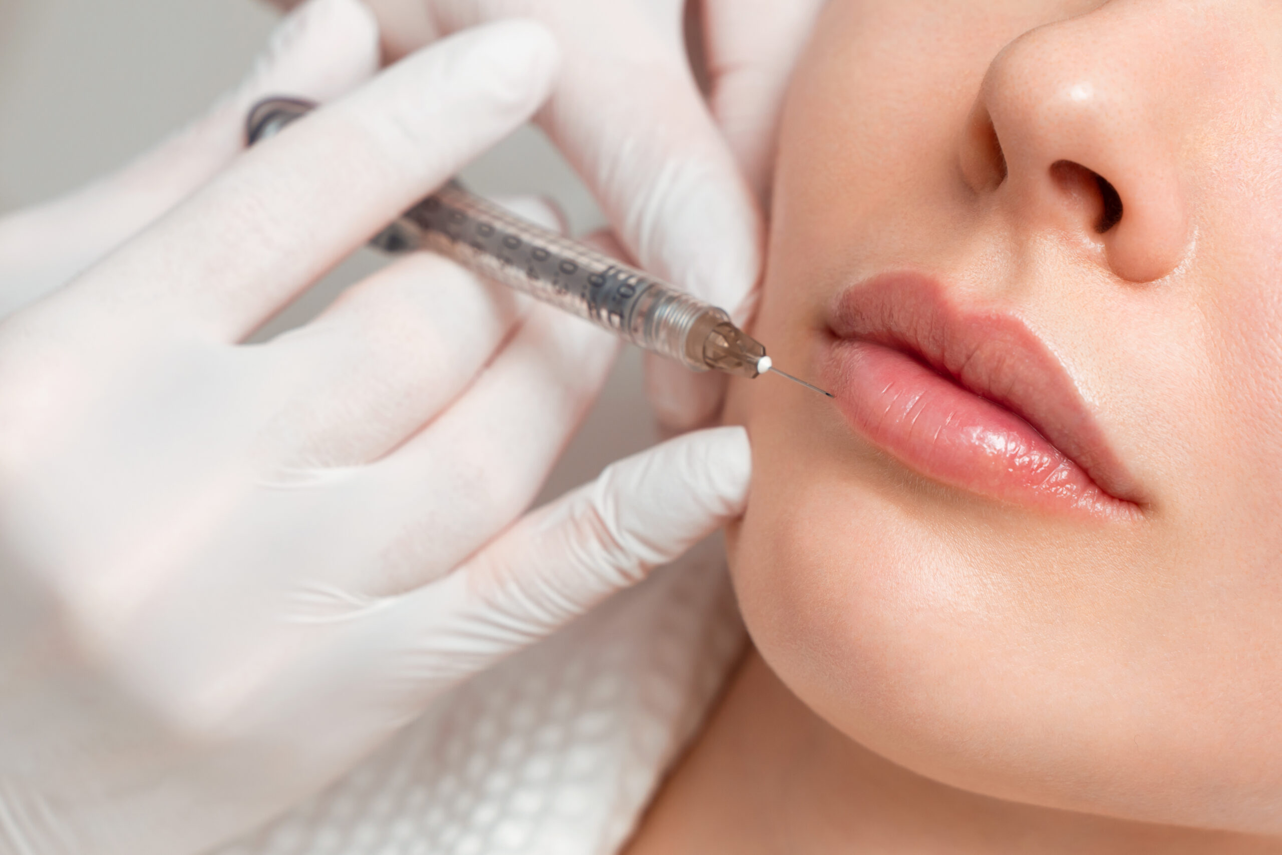 Dermal Fillers