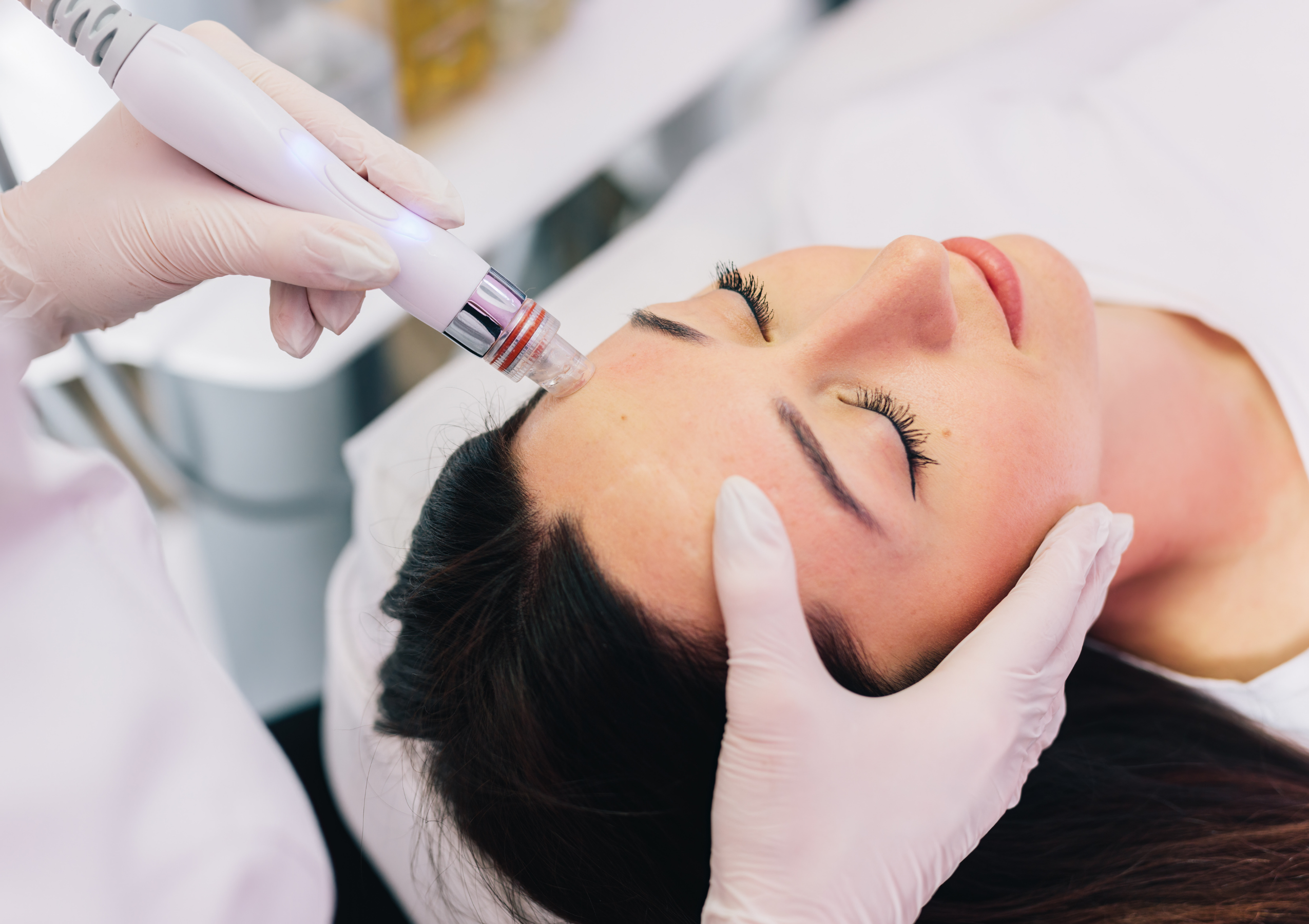 Gloved clinician applies a handheld facial device to a woman's cheek during a cosmetic treatment while she lies down.