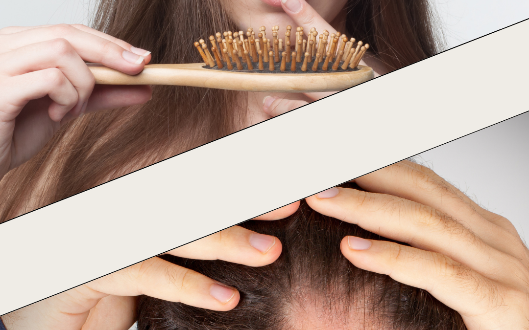 Male vs. Female Pattern Hair Loss: Causes & Treatment Guide